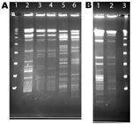 Thumbnail of Pulsed field gel electrophoresis (PFGE) of AseI digest patterns of patient and household isolates, New York, New York, USA, 2001–2011. A) Patient and household isolates. Lane 1, λ ladder; lane 2, patient no. 5 Mycobacterium avium isolate AG-P-1; lane 3, patient no. 5 household filter M. avium isolate AG-F-2–0-2; lane 4, patient no. 5 household filter M. avium isolate AG-F-2-I-1(environmental isolates in lanes 3 and 4 are indistinguishable; patient isolate in lane 2 considered clonal