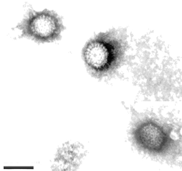 Electron micrographs of purified DRV-TH11 isolate particles showing the features of orthoreovirus. Original magnification ×100,000. Scale bar = 100 nm.