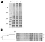 Thumbnail of Results of PCR ribotyping of Clostridium difficile 027 strains from Chile. M indicates the 100-bp DNA ladder; lane 2, R20291; lane 2, PUC47; lane 3, PUC51. A) PCR ribotyping of C. difficile isolates. PCR results show that that the band pattern of the ribosomal intergenic regions of strains PUC47 and PUC51 are similar to those of the reference (epidemic) strain R20291. B) Cluster analysis of strains PUC47, PUC51, and the epidemic strain 027 R20291 shows &gt;99% similarity and that th