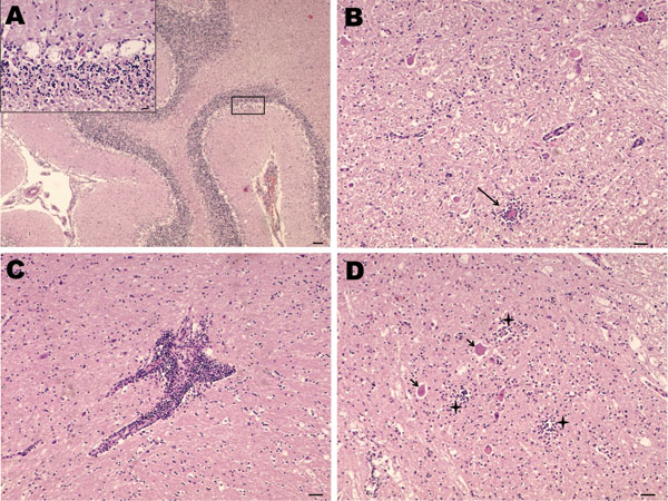 Nonsuppurative encephalitis in goat affected by louping ill. A) Cerebellum with necrosis of Purkinje cells. Hematoxylin and eosin (H&amp;E) stain; scale bar = 100 µm. Inset: necrosis of Purkinje cells. H&amp;E stain; scale bar = 20 µm. B) Midbrain. Area of neurophagia (arrow) surrounded by microglial cells. Necrosis of neurons can be also seen. H&amp;E stain; scale bar = 50 µm. C) Lymphoid perivascular cuff in midbrain. H&amp;E stain; scale bar = 50 µm. D) Spinal cord, gray matter. Focal microgl