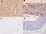 Thumbnail of Results of immunohistochemical staining using monoclonal antibody 6G2 and the ABC complex technique of liver and intestine samples from young rabbits infected with rabbit hemorrhagic disease virus (RHDV) isolate RHDV-N11 and control rabbits. A) Liver of RHDV-N11–infected rabbit. Hepatocytes show intense 6G2-specific immunolabeling. Scale bar = 50 µm. B) Intestinal villi in small intestine of RHDV-N11–infected rabbit. Areas of focal necrosis and epithelial cells show strong immunolab