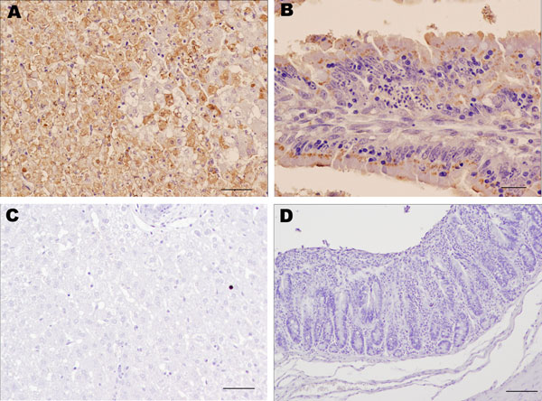 Results of immunohistochemical staining using monoclonal antibody 6G2 and the ABC complex technique of liver and intestine samples from young rabbits infected with rabbit hemorrhagic disease virus (RHDV) isolate RHDV-N11 and control rabbits. A) Liver of RHDV-N11–infected rabbit. Hepatocytes show intense 6G2-specific immunolabeling. Scale bar = 50 µm. B) Intestinal villi in small intestine of RHDV-N11–infected rabbit. Areas of focal necrosis and epithelial cells show strong immunolabeling. Scale 