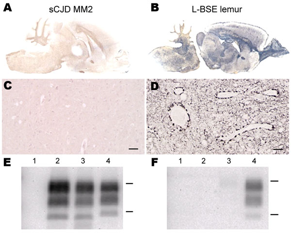 Susceptibility of Syrian golden hamsters to MM2-cortical subtype sporadic Creutzfeldt-Jakob disease (sCJD) and L-type bovine spongiform encephalopathy (L-BSE) prions. Disease-associated prion protein (PrPd) was analyzed in brains of hamsters injected with human MM2-cortical sCJD and L-BSE from a mouse lemur by paraffin-embedded tissue blot (A, B), immunohistochemistry (C, D), or Western blot (E, F). Monoclonal antibodies against prion protein were SAF84 (A–D), SHa31 (E), and 12B2 (F). C, D) Scal