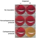 Thumbnail of Representative results of the Carba NP test. The Carba NP test was performed with a noncarbapenemase producer (Escherichia coli producing the extended-spectrum β-lactamase CTX-M-15, upper panel) and with a carbapenemase producer (Klebsiella pneumoniae–producing New Delhi metallo-β-lactamase-1, lower panel) in a reaction medium without (left panel) and with (right panel) imipenem. Uninoculated wells are shown as controls. Photographs were taken after a 1.5-hour incubation.