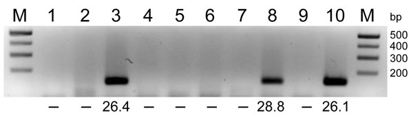 RNA extracted from pools of Culicoides obsoletus group midges was tested in 1-step reverse transcription quantitative PCRs (RT-qPCRs) for the Schmallenberg virus L segment, and the products were analyzed by agarose gel electrophoresis. Lanes 1–8, C. obsoletus group midge pools 1–8; lanes 9–10; negative and positive controls, respectively. Numbers below lanes are cycle threshold values from RT-qPCRs; –, no value. M, size marker. Amplicons (145 bp) from positive pools were extracted and sequenced.