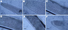 Thumbnail of Light micrographs of Thelazia callipaeda showing A) posterior and B) anterior portion with cephalic end and buccal capsule; C) anterior portion containing embryonated eggs; D) middle portion containing rounded first-stage larvae; E) posterior portion containing first-stage larvae; F) caudal end. Scale bars = 25 µm.