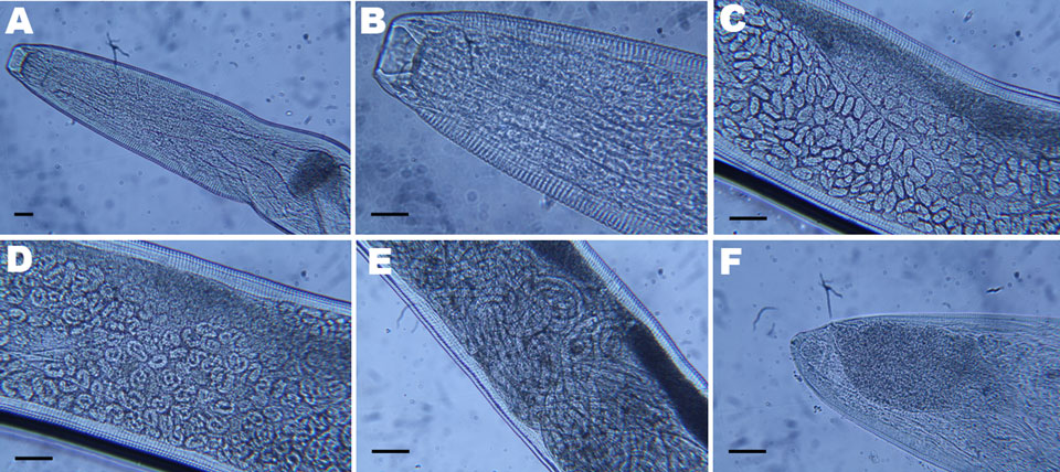 Light micrographs of Thelazia callipaeda showing A) posterior and B) anterior portion with cephalic end and buccal capsule; C) anterior portion containing embryonated eggs; D) middle portion containing rounded first-stage larvae; E) posterior portion containing first-stage larvae; F) caudal end. Scale bars = 25 µm.