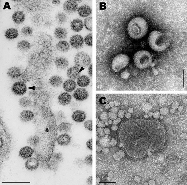 A) Transmission electron micrograph of an ultrathin section of Vero cells infected with Cygnet River virus (CyRV) from a Muscovy duck, Australia. Arrow, virus budding from the plasma membrane; arrowhead, sand-like structures. *Host cell projection. Scale bar = 200 nm. B and C) Transmission electron micrographs of CyRV prepared by negative-contrast electron microscopy. Scale bars = 100 nm. Preparations were derived from supernatant of CyRV-infected Vero cells (B) and from allantoic fluid of CyRV-