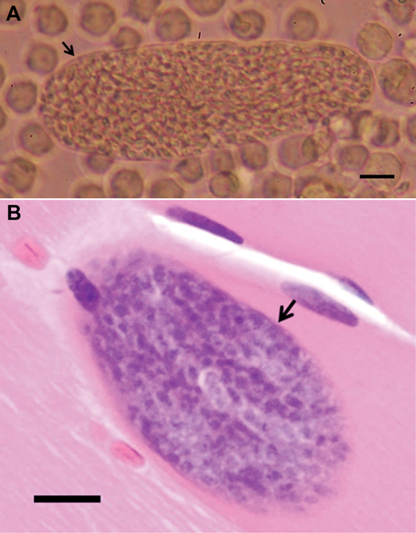 A) Sarcocysts isolated from persons infected with Sacrocystis nesbetti, Pangkor Island, Malaysia, 2012. Intact human sarcocyst (length 190 µm) with thin cyst wall (arrow) from homogenized temporalis tissue inoculated into a U937 monocytic cell culture (original magnification ×200, scale bar = 20 µm). B) Intramuscular sarcocyst enclosed by a thin smooth cyst wall (arrow) without any protrusions. Maximum cyst wall thickness is ≈0.5 µm (hematoxylin and eosin stained, original magnification ×40, sca