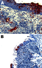 Thumbnail of Nipah virus (NiV) antigen in acutely inflamed tonsillar tissue and overlying epithelium (A) and nasopharyngeal epithelium (B) in 2 ferrets infected with NiV-Bangladesh. Rabbit α-NiV N protein antiserum. Original magnification ×200. 