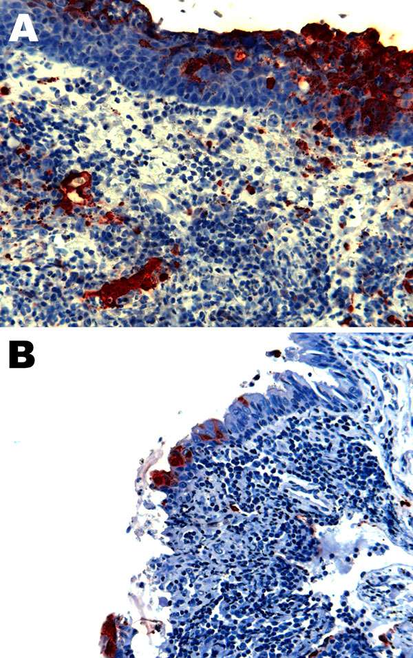 Nipah virus (NiV) antigen in acutely inflamed tonsillar tissue and overlying epithelium (A) and nasopharyngeal epithelium (B) in 2 ferrets infected with NiV-Bangladesh. Rabbit α-NiV N protein antiserum. Original magnification ×200. 