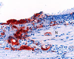 Thumbnail of Olfactory epithelium of a ferret infected with Nipah virus (NiV)-Bangladesh. NiV antigen was observed in close association with submucosal nerve fibers (N). Rabbit α-NiV N protein antiserum. Original magnification ×200. 