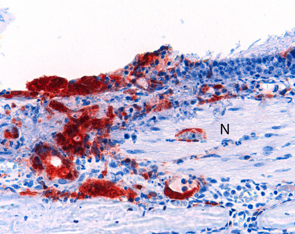 Olfactory epithelium of a ferret infected with Nipah virus (NiV)-Bangladesh. NiV antigen was observed in close association with submucosal nerve fibers (N). Rabbit α-NiV N protein antiserum. Original magnification ×200. 