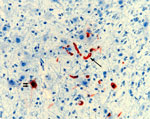 Thumbnail of Nipah virus (NiV) antigen in neuron (double arrows) and capillary endothelia (single arrow) of a ferret experimentally infected with NiV-Bangladesh. Rabbit α-NiV N protein antiserum. Original magnification ×200. 