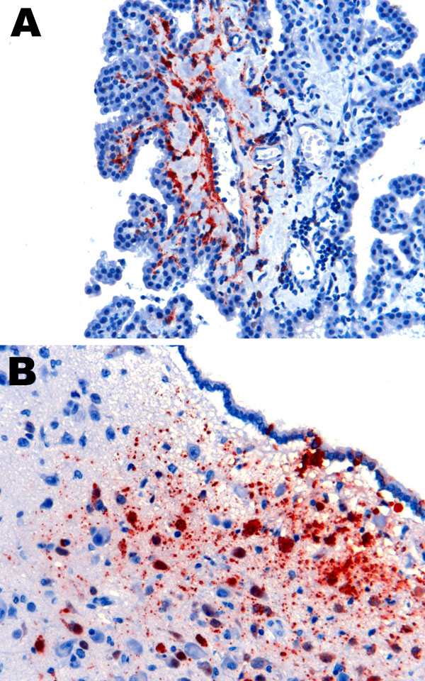 Nipah virus (NiV) antigen in ferret infected with NiV-Malaysia. A) Choroid plexus endothelium. B) ependymal epithelium and subependymal tissue, including neurons. Rabbit α-NiV N protein antiserum. Original magnification ×200. 