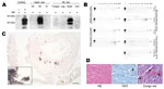 Thumbnail of Abundant PrPSc in heart of 1 bovine spongiform encephalopathy (BSE)–infected rhesus macaque. A) In sodium phosphotungstic acid precipitation of PrPSc, followed by Western blotting, highly abundant PrPSc was demonstrated in the heart of 1 BSE-infected primate. In this monkey, only the heart contained PrPSc. Controls include cardiac muscle spiked with minimal amounts brain of a healthy (–) and prion-diseased (+) primate. All analyses were prepared from 50 mg of tissue except the heart