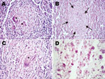 Thumbnail of Histopathologic examination of tissue samples from adult female chimpanzee that was found dead in Taï National Park, Côte d’Ivoire, on August 5, 2009. A) Hematoxylin and eosin (H&amp;E) stain of the spleen shows focal granulomatous inflammation with central accumulation of multinucleated Langhans giant cells (stars) B, C) H&amp;E stain of the liver shows focal granulomatous inflammation within liver parenchyma (B, arrow) and large granulomatous alteration demarcated by fibrous conne