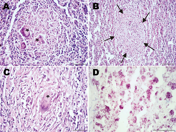 Histopathologic examination of tissue samples from adult female chimpanzee that was found dead in Taï National Park, Côte d’Ivoire, on August 5, 2009. A) Hematoxylin and eosin (H&amp;E) stain of the spleen shows focal granulomatous inflammation with central accumulation of multinucleated Langhans giant cells (stars) B, C) H&amp;E stain of the liver shows focal granulomatous inflammation within liver parenchyma (B, arrow) and large granulomatous alteration demarcated by fibrous connective tissue 