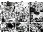 Thumbnail of Morphologic changes in Norwalk virus (NV)–infected 3-dimensional INT-407 aggregates. Phase contrast micrographs of 3-dimensional intestinal aggregates cultured in the rotating wall vessel bioreactor and subsequently inoculated with live NV (panels A–C), inactivated NV (γ-inactivated) (panels D–F), or phosphate-buffered saline (mock-uninfected control) (panels G–I) at 6, 12, and 24 h after inoculation. Arrows indicate cells (or cellular debris) that were released from the support bea