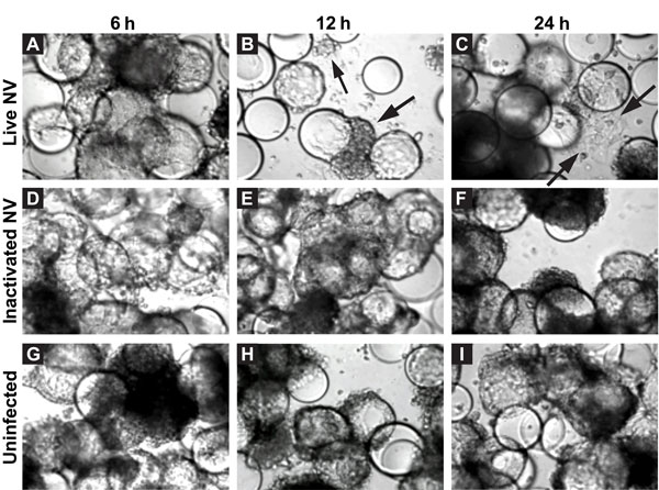 Morphologic changes in Norwalk virus (NV)–infected 3-dimensional INT-407 aggregates. Phase contrast micrographs of 3-dimensional intestinal aggregates cultured in the rotating wall vessel bioreactor and subsequently inoculated with live NV (panels A–C), inactivated NV (γ-inactivated) (panels D–F), or phosphate-buffered saline (mock-uninfected control) (panels G–I) at 6, 12, and 24 h after inoculation. Arrows indicate cells (or cellular debris) that were released from the support beads. The beads