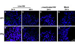 Thumbnail of No evidence of productive Norwalk virus (NV) replication in 3-dimensional INT-407 aggregates by confocal microscopy analysis of viral proteins. Three-dimensional INT-407 aggregates 24 h post inocupation (hpi) (panels A, B) and 48 hpi (panels C, D) with live NV, 24 hpi with inactivated NV (panels E, F), or phosphate-buffered saline alone (positive controls) (panels G, H). Aggregates were stained for viral capsid protein 1 (VP1) (panels A, C, E, G) or nonstructural protein VPg (panels