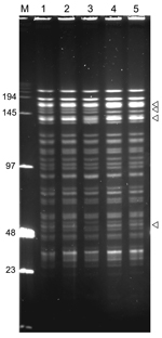 Thumbnail of NotI pulsed-field gel electrophoresis patterns of Yersinia pestis isolates from plague outbreak in Algeria, 2009. Lane M, low-range DNA marker (New England Biolabs, Ipswich, MA, USA); lane 1, IP1860 (Kehailia); lane 2, IP1861 (Hama Ali); lane 3, IP1862 (Hamoul); lane 4, IP1863 (Ain Temouchent); lane 5, IP1864 (Ain Temouchent). Values on the left are in kilodaltons. Arrowheads indicate positions of variable bands.