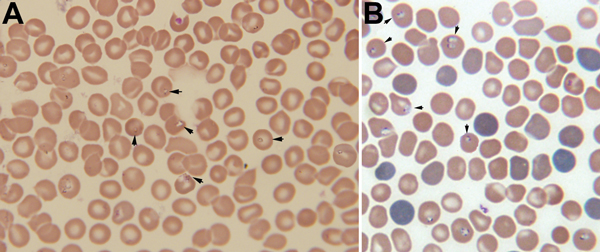 A) Giemsa-stained thin blood smear for an 8-year-old boy from China showing erythrocytes with typical ring forms, paired pyriforms, and tetrads of a Babesia sp. (arrows). B) Giemsa-stained thin blood smear for a mouse with severely combined immunodeficiency, which had been injected with blood from the patient, showing Babesia sp.–infected erythrocytes (arrows). Original magnifications ×1,000.