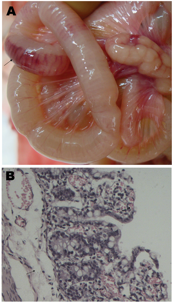 Signs of porcine epidemic diarrhea virus in piglets, China, November 2010–April 2012. A) Hemorrhage in the intestinal wall. B) Congestion, edema, and epithelial cell shedding in the intestinal mucosa. Hematoxylin and eosin stain; original magnification ×200.