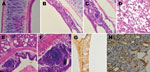 Thumbnail of Histological appearance and immunohistochemical staining of respiratory tract samples collected from chickens before and after inoculation with avian metapneumovirus (aMPV) subgroup C, China. A) Trachea section from an uninoculated chicken shows intact ciliated epithelium. B) At 5 days’ postinoculation, loss of cilia, architectural disruption, and infiltration of inflammatory cells were seen in most of the epithelium and submucosa of inoculated chickens. C) Same lymphoid cell infilt