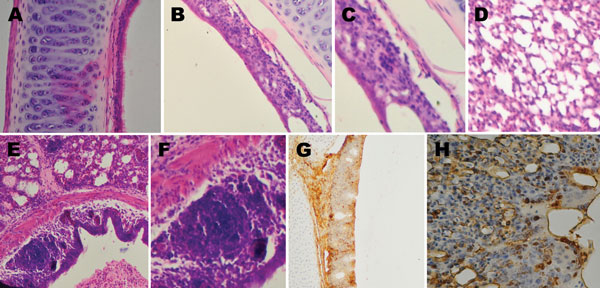 Histological appearance and immunohistochemical staining of respiratory tract samples collected from chickens before and after inoculation with avian metapneumovirus (aMPV) subgroup C, China. A) Trachea section from an uninoculated chicken shows intact ciliated epithelium. B) At 5 days’ postinoculation, loss of cilia, architectural disruption, and infiltration of inflammatory cells were seen in most of the epithelium and submucosa of inoculated chickens. C) Same lymphoid cell infiltration in tra