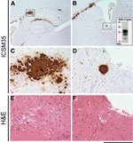 Thumbnail of Immunohistochemical analysis of cattle bovine spongiform encephalopathy (BSE) prion–infected 129MM Tg35c mouse brain. Hippocampal region (A) and striatum (B) from a transgenic 129MM Tg35c mouse with subclinical prion infection culled 700 days after inoculation with cattle BSE prion inoculum I038. Panels A–D show abnormal prion protein (PrP) immunoreactivity stained with monoclonal antibody ICSM35 against PrP Panels E and F show hematoxylin and eosin–stained sections. Boxed regions i