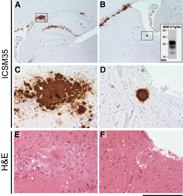 Immunohistochemical analysis of cattle bovine spongiform encephalopathy (BSE) prion–infected 129MM Tg35c mouse brain. Hippocampal region (A) and striatum (B) from a transgenic 129MM Tg35c mouse with subclinical prion infection culled 700 days after inoculation with cattle BSE prion inoculum I038. Panels A–D show abnormal prion protein (PrP) immunoreactivity stained with monoclonal antibody ICSM35 against PrP Panels E and F show hematoxylin and eosin–stained sections. Boxed regions in panels A an