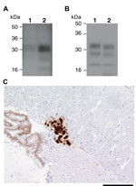 Thumbnail of Ovine bovine spongiform encephalopathy (BSE) prion transmission to a 129MMTg35c mouse. Panel A shows immunoblot detection of disease-related prion protein (PrPSc) in 10 μL of proteinase K (PK)–digested 10% (w/v) brain homogenates from ovine BSE (SE 1929/0877) (lane 1) and secondary passage ovine BSE (SE1945/0032) (lane 2) using  monoclonal antibody ICSM35 against prion protein (PrP). Panel B shows type 4 PrPSc in 1 μL of PK-digested 10% (w/v) vCJD brain homogenate (lane 1) in compar