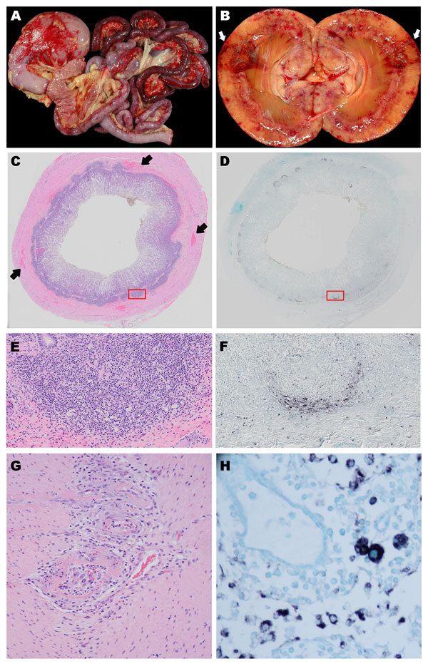 Organ tissues from sentinel dog (dog 1) and 2 other dogs (dogs 2 and 3) that were positive by in situ hybridization (ISH) analysis for dog circovirus (DogCV). A) Gross view of the gastrointestinal system from dog 1. Multifocal to coalescing hemorrhages are shown in the stomach and intestinal serosa. B) Gross view of the kidney from dog 2. Segmental regions of hemorrhage and necrosis (infarction) can be seen within the cortex and radiating from the medullary papilla to the capsule. C) Hemolyxin a