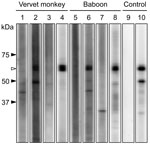Thumbnail of Western blot analysis of purified recombinant N protein from human parainfluenza virus type 3. Western blot analysis was performed by using serum specimens from vervet monkeys (lanes 1–4) and baboons (lanes 5–8) in the Mfuwe (lanes 1, 2, 5, 6) and Livingstone (lanes 3, 4, 7, 8) regions. Results of representative antibody-negative (lanes 1, 3, 5, 7) and antibody-positive (lanes 2, 4, 6, 8) samples are shown. Mock antibody (lane 9) and HPIV monoclonal antibody (lane 10) were used as n