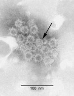 Thumbnail of Electron microscopy of negative-stained orthohepadnavirus particles from a bat (arrow). Clumps of Australia antigen–like particles are seen.