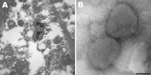 A) Electron micrograph of poxvirus particles in synovium of a big brown bat, northwestern United States. B) Negative staining of poxvirus particles in cell culture supernatant. Scale bar = 100 nm.