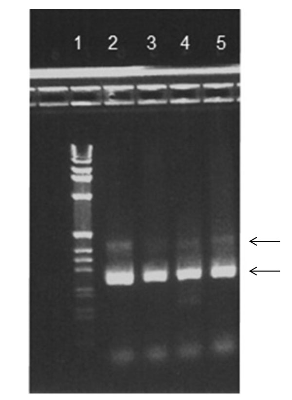 Agarose gel stained with ethidium bromide. Reverse transcription PCR products from 4 patients are shown in lanes 2–5 and 1-kb DNA Ladder (Life Technologies Corp., Carlsbad, CA, USA) in lane 1. Arrows indicate 2 bands corresponding to ≈250 and ≈400 bp.