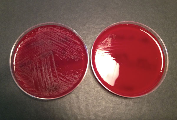 Blood agar plates with (left) and without (right) pyridoxal supplement from a study of neonatal Granulicatella elegans bacteremia, London, UK.