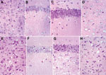 Thumbnail of Comparison between homozygous bovine prion protein (BoPrP)-Tg110+/+ control mice (panels A–D) and hemizygous 113LBoPrP-Tg037+/− mice with end-stage disease (panels E–H) in parietal cortex (panels A and E), CA1 region of the hipocampus (panels B and F), dentate gyrus (panels C and G), and medial thalamus (panels D and H). Severe spongiosis is seen in the cerebral cortex, hilus ofdentate gyrus, and medial thalamus, but not in the CA1 area of the hippocampus and granule cell layer of t