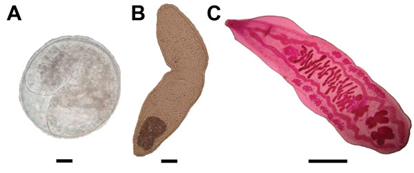Morphologic appearance of different stages of Opisthorchis viverrinia flukes. A) Encysted metacercariae. Scale bar indicates 30 μ. . B) Metacercariae released from cyst. Scale bar indicates 30 μ. C) Carmine-stained adult worm from experimentally infected hamster. Scale bar indicates 1 mm.