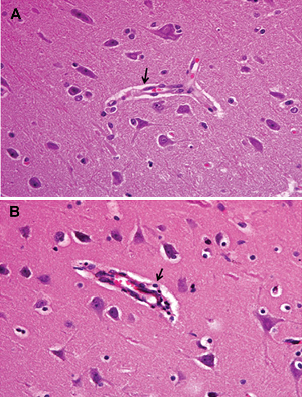 Brain tissue of an unvaccinated control pig (A) and pig inoculated with pseudorabies virus strain HeN1 (B). Arrows indicate lymphocyte infiltration around the small blood vessels in the brain cortex. Original magnification ×100.