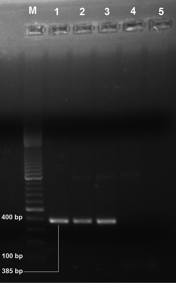 Electrophoretogram of Leishmania donovani kinetoplast DNA-specific PCR products (385 bp) isolated from patients with suspected post–kala-azar dermal leishmaniasis, Assam, India. Lane M, 100-bp DNA ladder; lanes 1–4, suspected post–kala-azar dermal leishmaniasis case-patient; lane 5, negative control. PCR products were visualized by staining with ethidium bromide after electrophoresis in 1% agarose gel.
