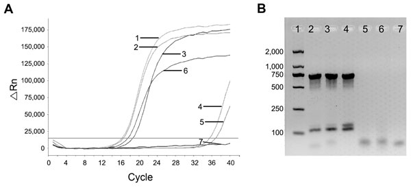 Detection and identification of Brucella DNA. A) Detection of Brucella DNA by quantitative PCR. Numbers indicate amplification curves with cycle threshold (Ct) values representative of samples. Curve 1, sample from patient 1 with 16 Ct value; curve 2, sample from patient 2 with 16 Ct; curve 3, sample from patient 3 with 17 Ct; curve 4, stem cells of cord blood from patient 1 with 34 Ct; curve 5, stem cells of cord blood from patient 2 with 34.5 Ct; curve 6, positive control with 18 Ct, curve 7, 