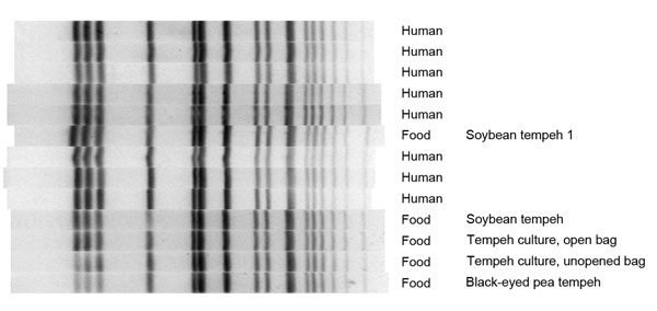 Pulse-field gel electrophoresis dendrogram showing Xba1 enzyme band patterns for 8 case-patients, tempeh, and Rhizopus spp. starter culture associated with outbreak of Salmonella enterica serovar Paratyphi B variant L(+) tartrate(+) gastroenteritis, by date of symptom onset, North Carolina, USA, 2012.