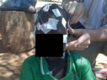 Thumbnail of Child with nodding syndrome, on whom electroencephalographic leads are being attached, Uganda, 2009.