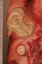 Thumbnail of Pseudotuberculosis-like caseous abscesses caused by Corynebacterium ulcerans in wild boar S28/3/13.