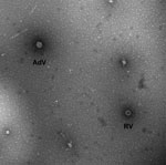 Thumbnail of Transmission electron micrograph image of stool sample from 36-month-old child with diarrhea, showing viral particles characteristic of rotavirus (RV) and enteric adenovirus (AdV). Magnification ×92,300. Image courtesy of Charles Humphrey.