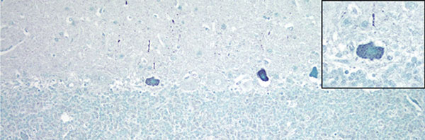 Cerebellum of a yearling steer with encephalomyelitis (animal 1). Punctate to diffuse positive (green) staining of Purkinje cells cytoplasm and dendritic processes can be seen; inset shows a higher magnification of a positive Purkinje cell. In situ hybridization for viral RNA. Original magnification ×400.