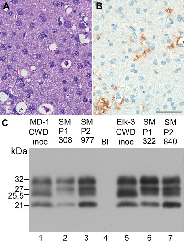 Neuropathologic features and immunoblot results of second-passage squirrel monkeys that had chronic wasting disease (CWD). Scale bar represents 50 µM and is applicable to panels A and B. Panels A and B show neuropathologic changes in the occipital lobe of SMP2-CWD monkey 977, which was euthanized at 24 months postinoculation. A) Hematoxylin and eosin staining show prominent spongiform changes. B) Immunohistochemical staining for disease-associated prion protein (PrPres) (brown) with anti-PrP ant